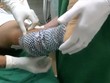 Da cá làm nguyên liệu để chữa trị bỏng