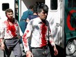 Đánh bom xe gần đại sứ quán Đức ở Afghanistan, 80 người chết