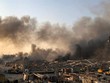 Gần 4.000 người thương vong trong vụ nổ tại Lebanon (Ảnh: Al Jazeera).