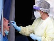 Nhân viên y tế lấy mẫu xét nghiệm nCoV tại Rome, Italy, ngày 18/8. Ảnh: Reuters.