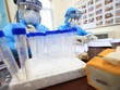 Các mẫu xét nghiệm test nhanh COVID-19 của các em học sinh trường Tiểu học Xuân Phương. (Ảnh: Thành Đạt/TTXVN).