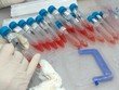 Bệnh viện Phổi Trung ương đã có văn bản gửi Sở Y tế Hưng Yên về trường hợp trên.