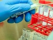 JCVI khuyến cáo Kl993 ưu đãi thưởng hấp dẫn Anh nên triển khai tiêm vaccine COVID-19 theo độ tuổi hơn là theo tính chất nghề nghiệp (Ảnh minh họa: KT).