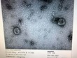 Viện vệ sinh dịch tễ Trung ương đã nuôi cấy và phân lập thành công virus corona mới. (Nguồn: Bộ Y tế)