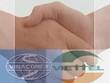 Nợ xấu sẽ “nóng” tại Đại hội VVF 