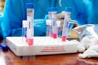 Các mẫu sinh phẩm xét nghiệm của người dân trong khu vực phong tỏa. (Ảnh: TTXVN phát).