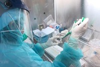 Lấy mẫu xét nghiệm virus SARS-CoV-2. (Ảnh: TTXVN).