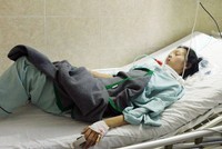 Một bệnh nhân nhập viện điều trị do ngộ độc botulinum sau khi ăn pate Minh Chay