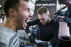 Một người đàn ông đang nhịn đau để cấy chip dưới da tay. Ảnh: AFP.