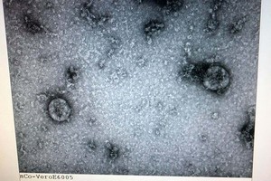 Viện vệ sinh dịch tễ Trung ương đã nuôi cấy và phân lập thành công virus corona mới. (Nguồn: Bộ Y tế)