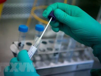 Nghiên cứu viên làm việc trên mẫu bệnh phẩm chứa virus corona chủng mới 2019-nCoV tại phòng thí nghiệm ở Stuttgart, miền Nam Đức ngày 29/1/2020. (Ảnh: AFP/TTXVN)