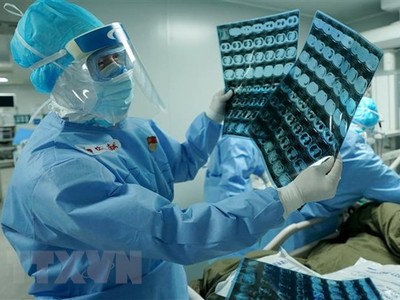 Bác sỹ kiểm tra hình chụp CT phổi của bệnh nhân nhiễm COVID-19 tại bệnh viện dã chiến ở Vũ Hán, tỉnh Hồ Bắc, Trung Quốc, ngày 17/3/2020. (Ảnh: THX/TTXVN).