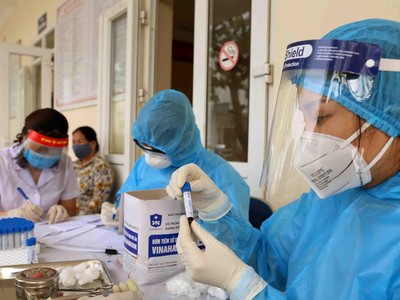 Xét nghiệm nhanh COVID-19. Ảnh: Vũ Sinh - TTXVN.