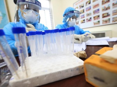 Các mẫu xét nghiệm test nhanh COVID-19 của các em học sinh trường Tiểu học Xuân Phương. (Ảnh: Thành Đạt/TTXVN).