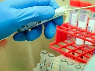 JCVI khuyến cáo Kl993 ưu đãi thưởng hấp dẫn Anh nên triển khai tiêm vaccine COVID-19 theo độ tuổi hơn là theo tính chất nghề nghiệp (Ảnh minh họa: KT).