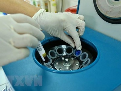 (Ảnh: TTXVN/Vietnam+).