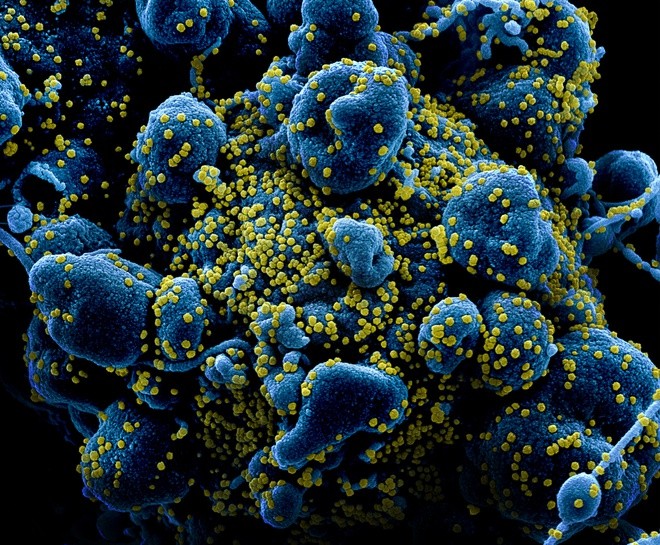 Trung Quốc tìm thấy kháng thể mới chống virus corona ảnh 1