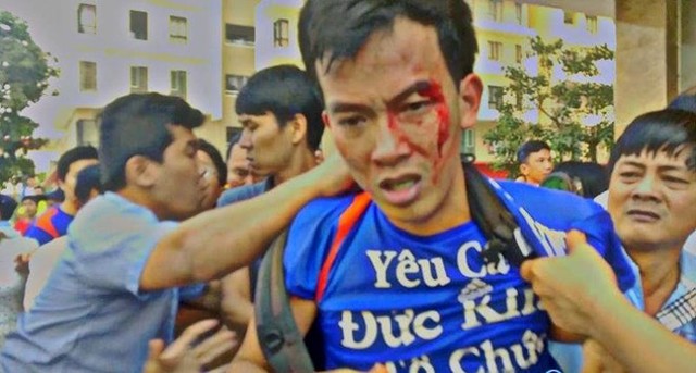 Vụ xô xát tại chung cư The Era Town: Chủ Kl99ok phiên bản mới vô can? ảnh 1