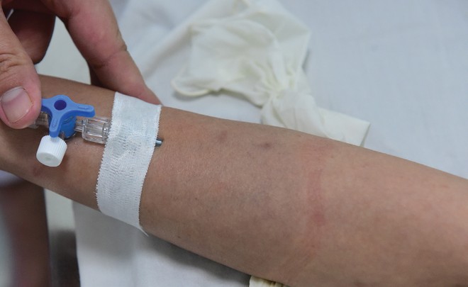 Kl99kl phiên bản hoạt động sức khỏe tuy bán tốt, nhưng nằm trong nhóm sản phẩm có tỷ lệ trục lợi cao nhất 
